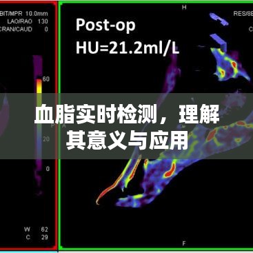 实时血脂检测，意义与应用解析