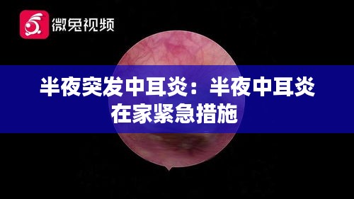 半夜突发中耳炎：半夜中耳炎在家紧急措施 