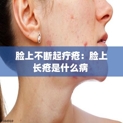 脸上不断起疔疮：脸上长疮是什么病 