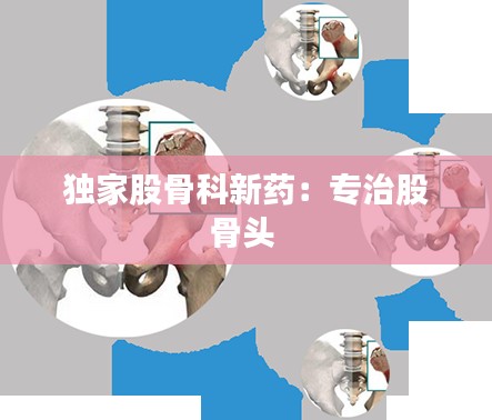 独家股骨科新药：专治股骨头 