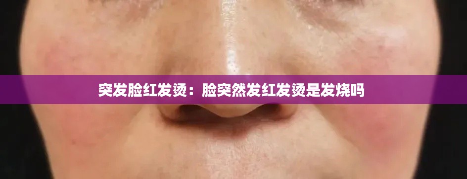 突发脸红发烫：脸突然发红发烫是发烧吗 