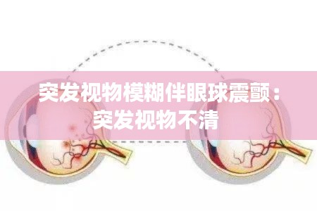 突发视物模糊伴眼球震颤：突发视物不清 