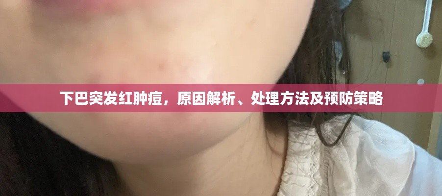 下巴突发红肿痘，原因解析、处理方法及预防策略