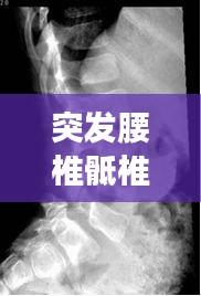 勃然大怒