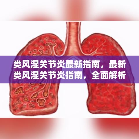 类风湿关节炎最新指南详解，治疗与日常管理的关键要素解析