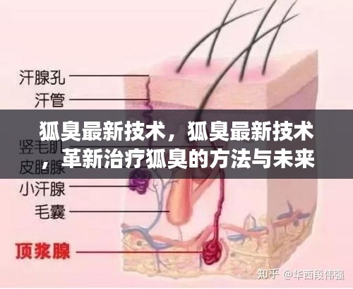 革新治疗狐臭的方法，最新技术及其未来展望