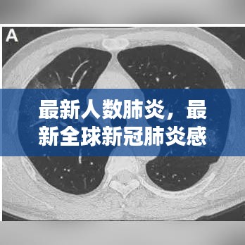 全球新冠肺炎感染人数动态分析与最新数据解读
