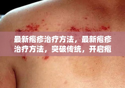 最新疱疹治疗方法突破传统，开启疱疹治疗新篇章