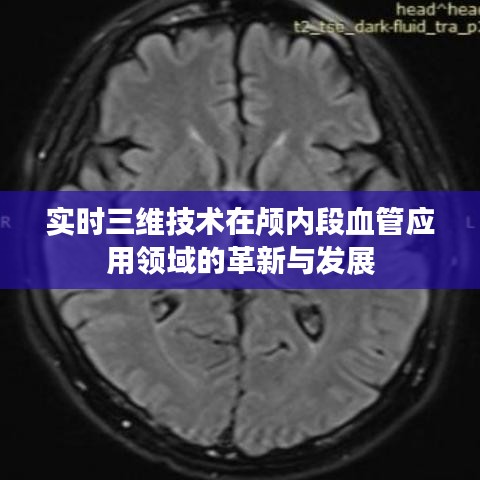 实时三维技术在颅内段血管应用领域的革新与进展