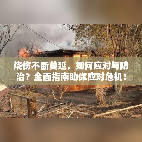 烧伤不断蔓延，如何应对与防治？全面指南助你应对危机！