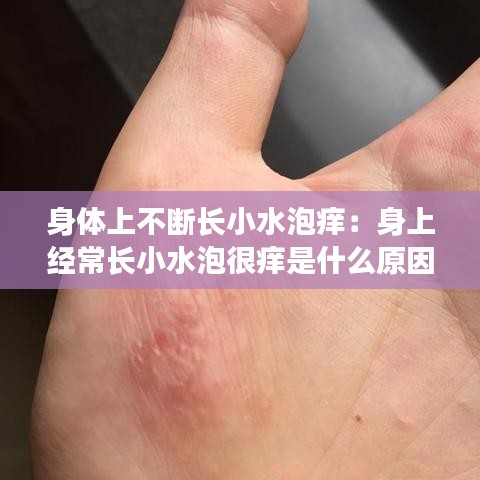 身体上不断长小水泡痒：身上经常长小水泡很痒是什么原因 