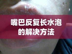 嘴巴反复长水泡的解决方法