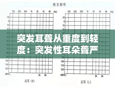 突发耳聋从重度到轻度：突发性耳朵聋严重 