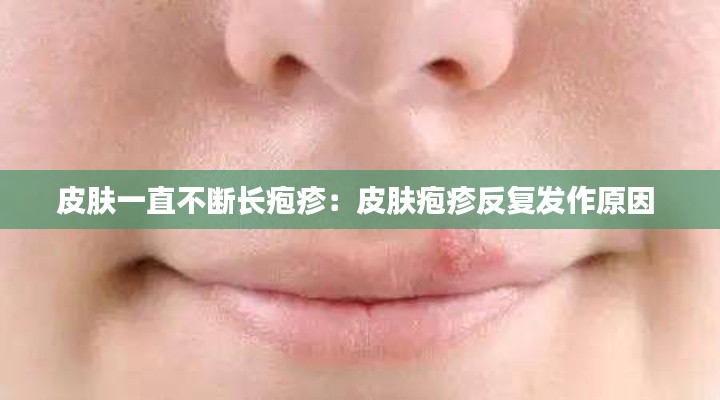皮肤一直不断长疱疹：皮肤疱疹反复发作原因 
