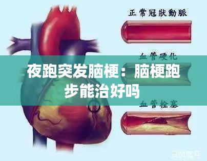 夜跑突发脑梗：脑梗跑步能治好吗 