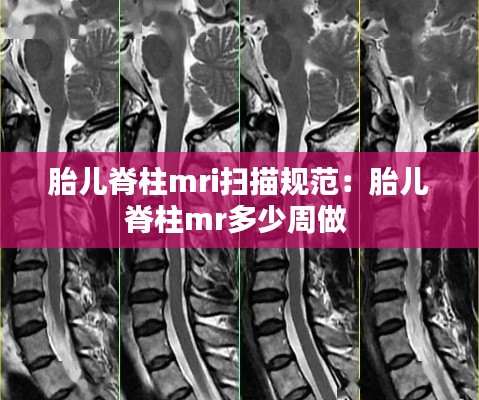 胎儿脊柱mri扫描规范：胎儿脊柱mr多少周做 