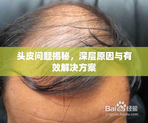 头皮问题揭秘，深层原因与有效解决方案