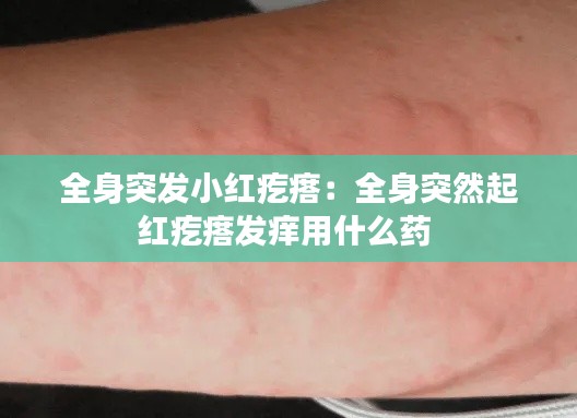 全身突发小红疙瘩：全身突然起红疙瘩发痒用什么药 