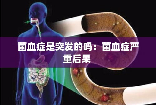 菌血症是突发的吗：菌血症严重后果 