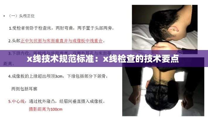 x线技术规范标准：x线检查的技术要点 