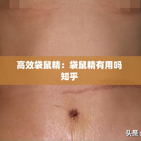 高效袋鼠精：袋鼠精有用吗 知乎 