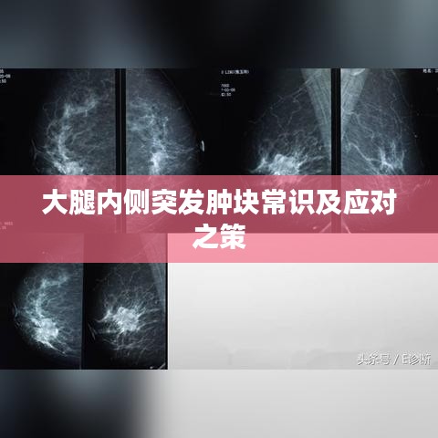 大腿内侧突发肿块常识及应对之策