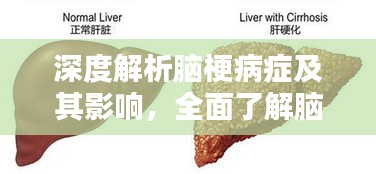 深度解析脑梗病症及其影响，全面了解脑梗危害