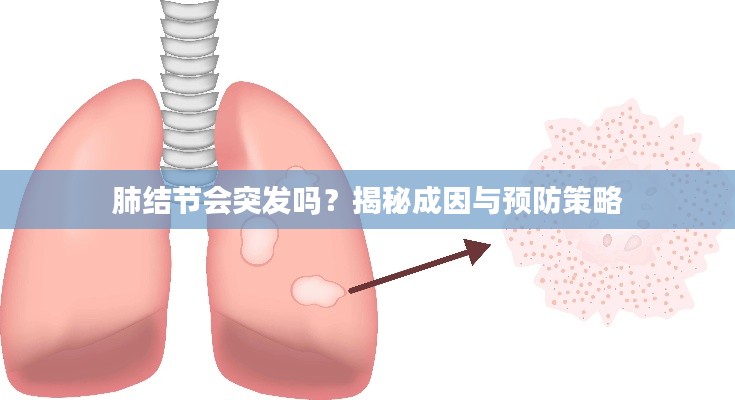 肺结节会突发吗？揭秘成因与预防策略