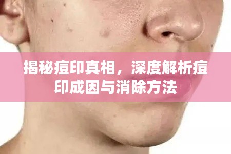 揭秘痘印真相，深度解析痘印成因与消除方法